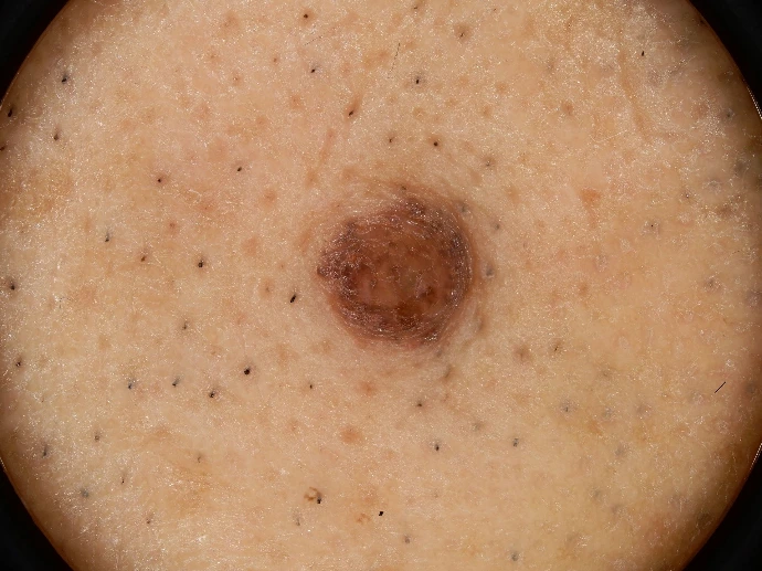 Image non polarisé