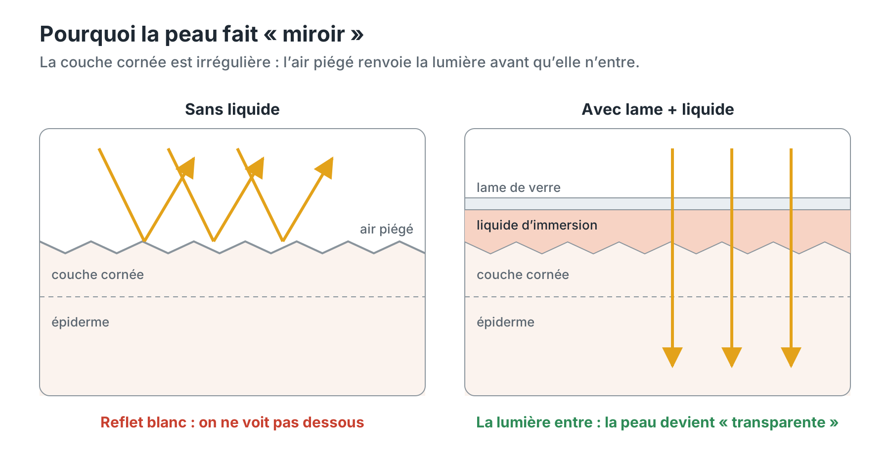 Pourquoi la peau fait miroir : sans liquide, la lumière rebondit sur la couche cornée ; avec lame et liquide, elle entre dans la peau.