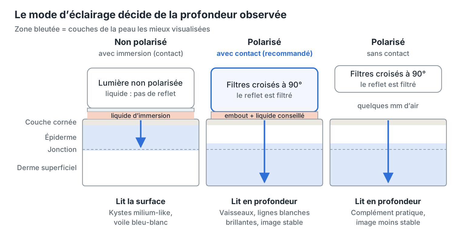 Les trois modes de dermoscopie et la profondeur observée