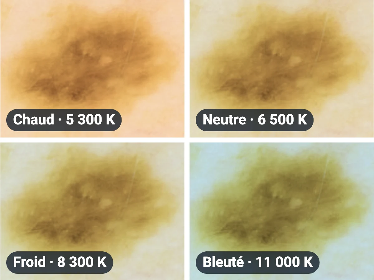 HEINE colorSHIFT : 4 températures de couleur, de 5 300 K à 11 000 K