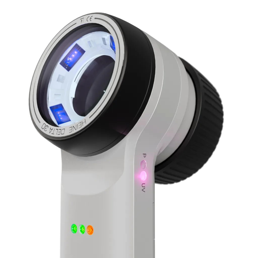 K-240.28.305-HEINE-DELTA-30-UV-close-up-3.webp